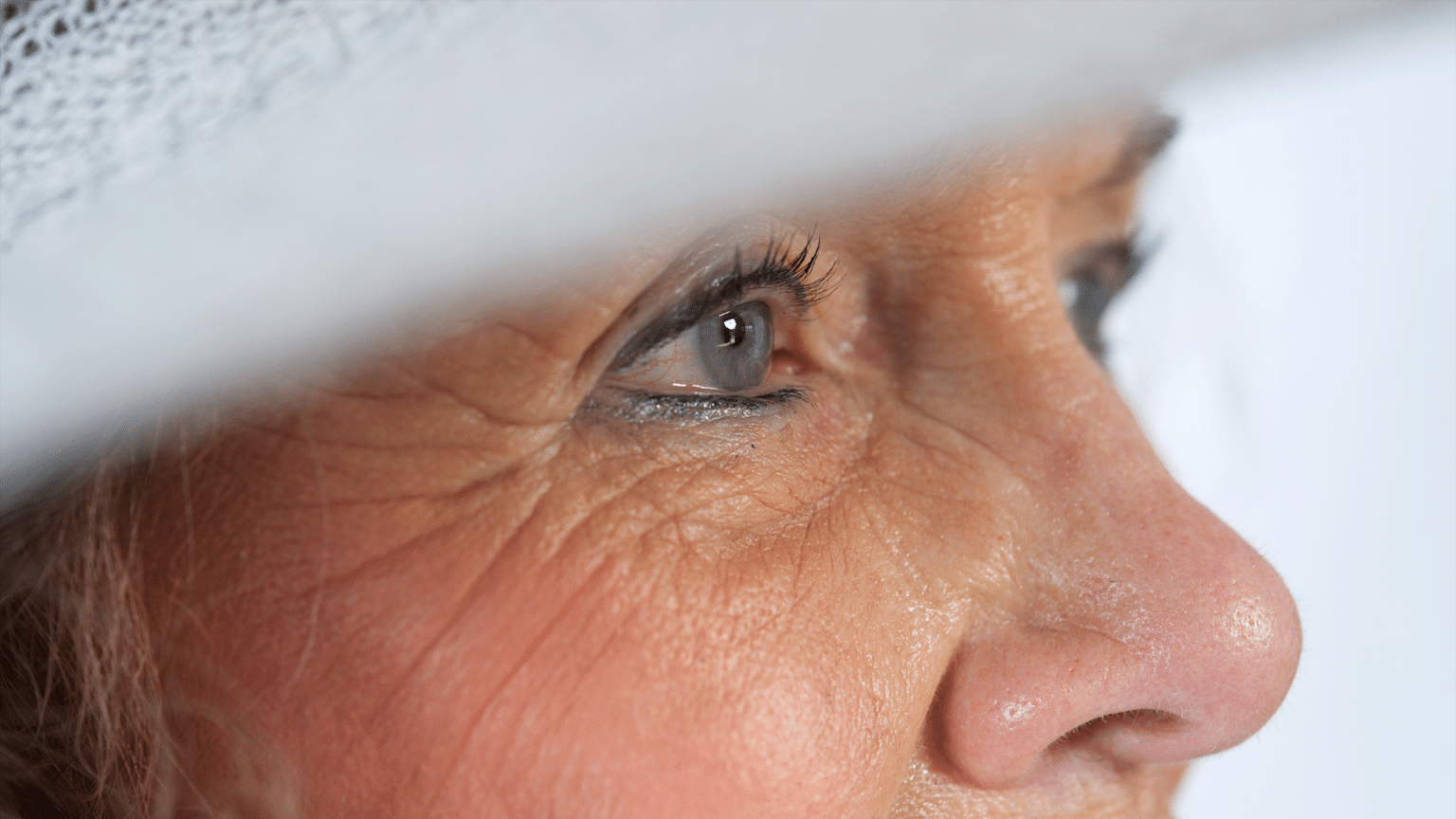 how-long-does-it-take-for-the-eye-to-heal-after-cataract-surgery